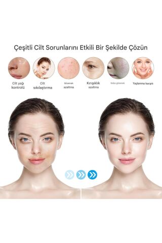 Profesyonel Kablosuz Dermapen Peelin Makinesi Kırışıklık Akne Yüz Vücut Güzellik Kalemi Dr Pen M8S