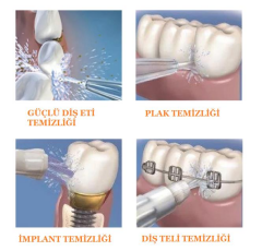 ALFA Waterpulse V300 Profesyonel Ağız Duşu Flosser 10 Modlu 120Psi 800ml 5 Uç Dahil
