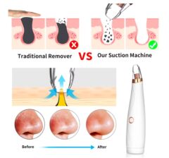 Vakumlu Akne Siyah Nokta Gözenek Yüz Temizleme Cihazı