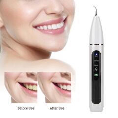 Anunnaki Akıllı Ultrasonik Diş Tartar Plak Parlatıcı Temizleyici